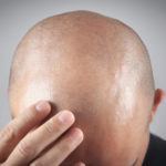Peut-on dormir sur le côté après une greffe de cheveux à Paris ?
