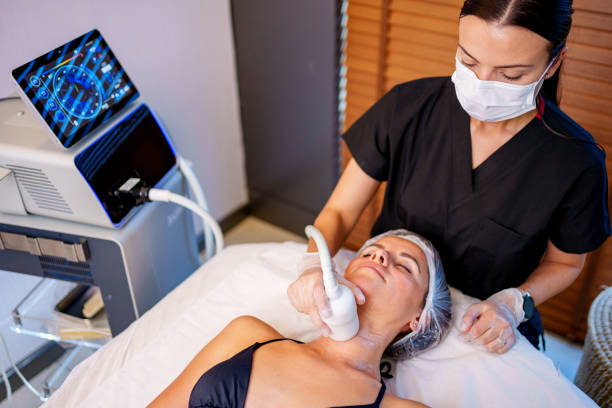 cryolipolyse à lyon