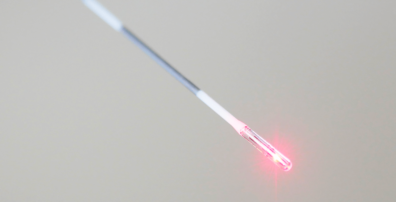 Hémorroïdes laser