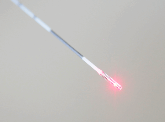 Hémorroïdes laser